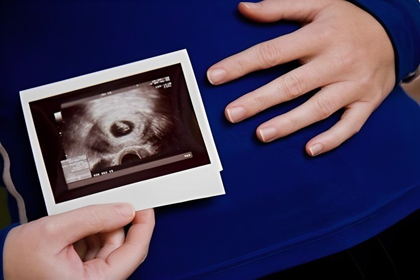 Thắc mắc mẹ bầu: Túi thai bao nhiêu mm thì có phôi thai?