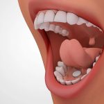 Chia sẻ: Tại sao phải ngậm thuốc phá thai dưới lưỡi?